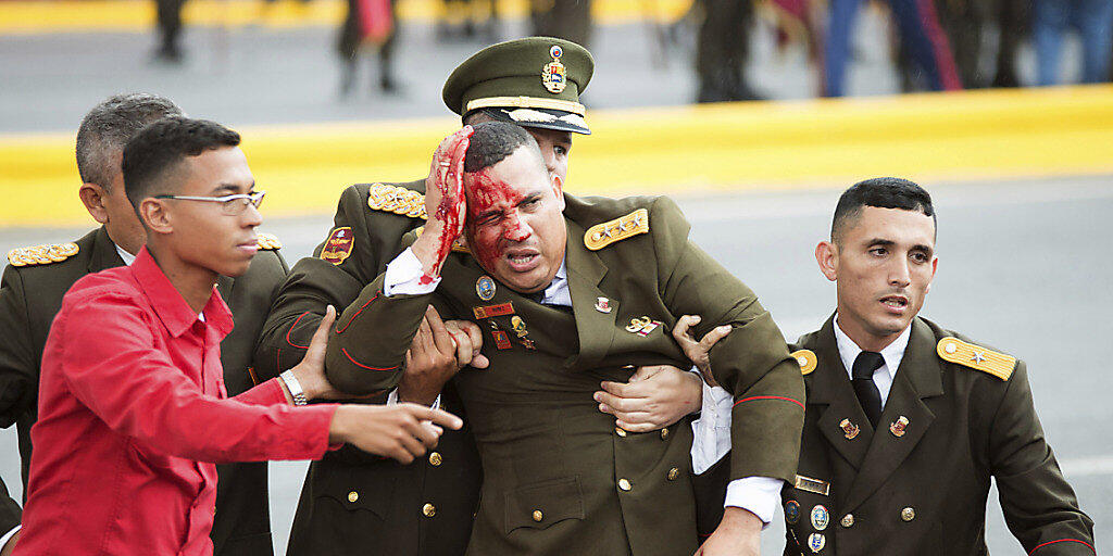 Verletzter venezolanischer Armee-Angehöriger nach dem angeblichen Anschlagsversuch auf Präsident Maduro in Caracas.
