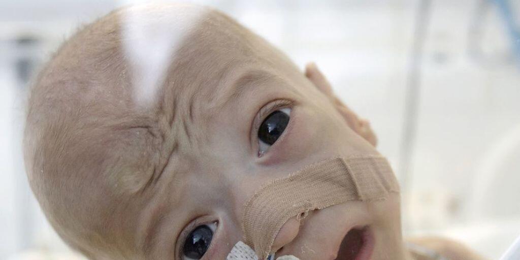 Ein rumänisches Baby auf der Intensivstation. EU-weit hat Rumänien neben Malta die höchste Säuglingsterblichkeitsrate. Bei einem EU-Durchschnitt von 3,6 - ungefähr wie in der Schweiz - liegt sie bei 6,7. (Archivbild) Ein rumänisches Baby auf der Intensivstation. EU-weit hat Rumänien neben Malta die höchste Säuglingsterblichkeitsrate. Bei einem EU-Durchschnitt von 3,6 - ungefähr wie in der Schweiz - liegt sie bei 6,7. (Archivbild)