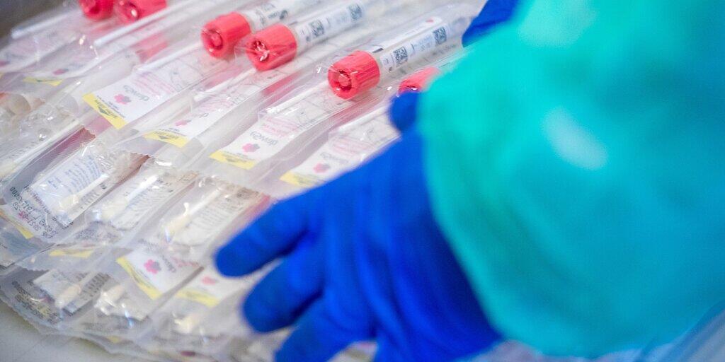 ARCHIV - Ein Mitarbeiter des Gesundheitswesens legt Testsets mit Abstrichstäbchen ab. Foto: Jens Büttner/dpa-Zentralbild/dpa/Symbolbild ARCHIV - Ein Mitarbeiter des Gesundheitswesens legt Testsets mit Abstrichstäbchen ab. Foto: Jens Büttner/dpa-Zentralbild/dpa/Symbolbild