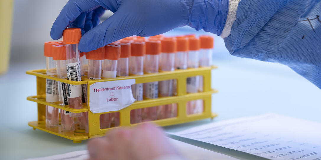 TRIEMLI, STADTSPITAL, SPITAL, LABOR, ZENTRALLABOR, LABORTAETIGKEITEN, TEST, TESTEN, TESTS, PROBE, PROBEN, CORONA-TEST, CORONA-PROBE, PCR-TEST, PCR, ANALYSE, AUSWERTUNG, CORONAVIRUS, CORONA, VIRUS, COVID-19, COVID 19, SARS-COV-2, NCOV-2019, 2019-N-COV, LAB TRIEMLI, STADTSPITAL, SPITAL, LABOR, ZENTRALLABOR, LABORTAETIGKEITEN, TEST, TESTEN, TESTS, PROBE, PROBEN, CORONA-TEST, CORONA-PROBE, PCR-TEST, PCR, ANALYSE, AUSWERTUNG, CORONAVIRUS, CORONA, VIRUS, COVID-19, COVID 19, SARS-COV-2, NCOV-2019, 2019-N-COV, LAB