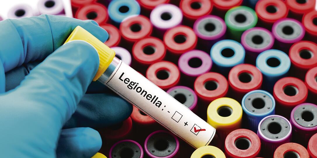 Legionella positive