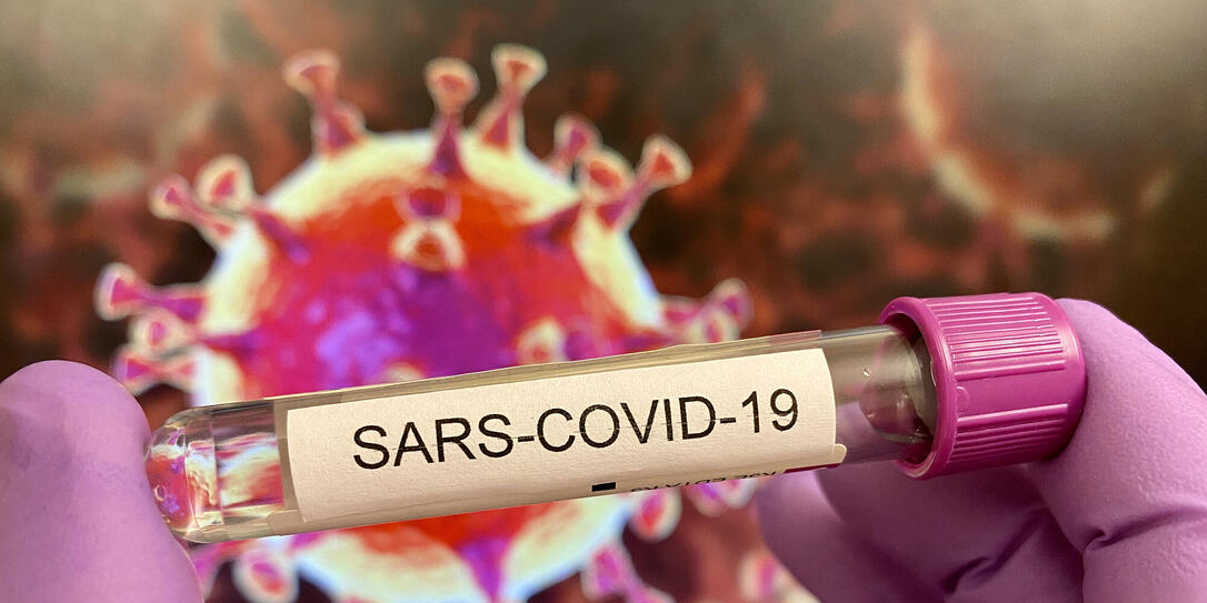 Sars-CoV-19 test tube, virus illustration on screen