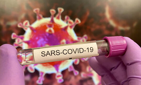 Sars-CoV-19 test tube, virus illustration on screen