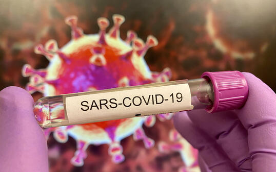 Sars-CoV-19 test tube, virus illustration on screen